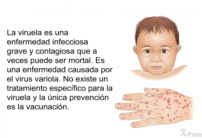 La viruela es una enfermedad infecciosa grave y contagiosa que a veces puede ser mortal. Es una enfermedad causada por el virus variola. No existe un tratamiento especfico para la viruela y la nica prevencin es la vacunacin.