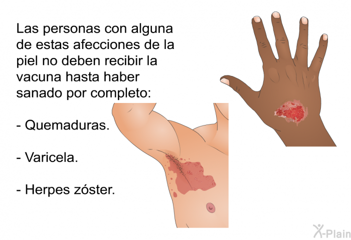 Las personas con alguna de estas afecciones de la piel no deben recibir la vacuna hasta haber sanado por completo:  Quemaduras. Varicela. Herpes z�ster.