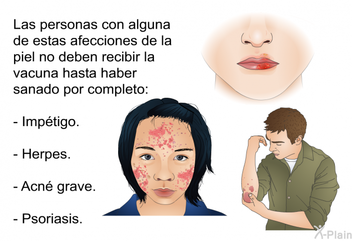 Las personas con alguna de estas afecciones de la piel no deben recibir la vacuna hasta haber sanado por completo:  Imp�tigo. Herpes. Acn� grave. Psoriasis.