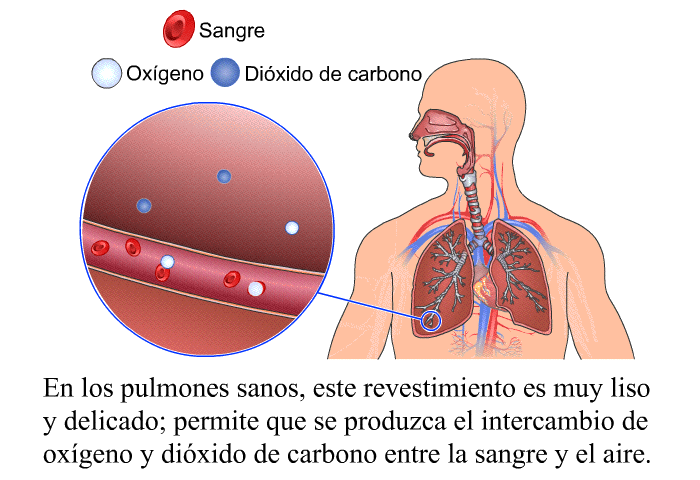 En los pulmones sanos, este revestimiento es muy liso y delicado; permite que se produzca el intercambio de ox�geno y di�xido de carbono entre la sangre y el aire.