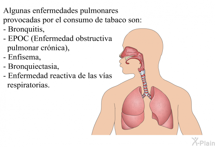 Algunas enfermedades pulmonares provocadas por el consumo de tabaco son:  Bronquitis, EPOC (Enfermedad obstructiva pulmonar cr�nica), Enfisema, Bronquiectasia, Enfermedad reactiva de las v�as respiratorias.
