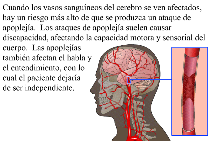 Cuando los vasos sanguneos del cerebro se ven afectados, hay un riesgo ms alto de que se produzca un ataque de apopleja . Los ataques de apopleja suelen causar discapacidad, afectando la capacidad motora y sensorial del cuerpo. Las apoplejas tambin afectan el habla y el entendimiento, con lo cual el paciente dejara de ser independiente.