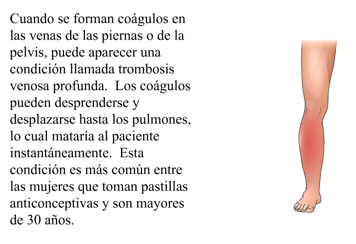 Cuando se forman cogulos en las venas de las piernas o de la pelvis, puede aparecer una condicin llamada <I>trombosis venosa profunda</I>. Los cogulos pueden desprenderse y desplazarse hasta los pulmones, lo cual matara al paciente instantneamente. Esta condicin es ms comn entre las mujeres que toman pastillas anticonceptivas y son mayores de 30 aos.