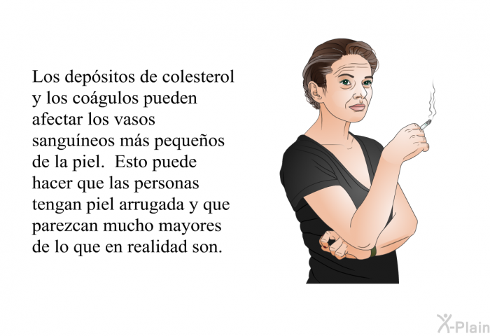 Los depsitos de colesterol y los cogulos pueden afectar los vasos sanguneos ms pequeos de la piel. Esto puede hacer que las personas tengan piel arrugada y que parezcan mucho mayores de lo que en realidad son.