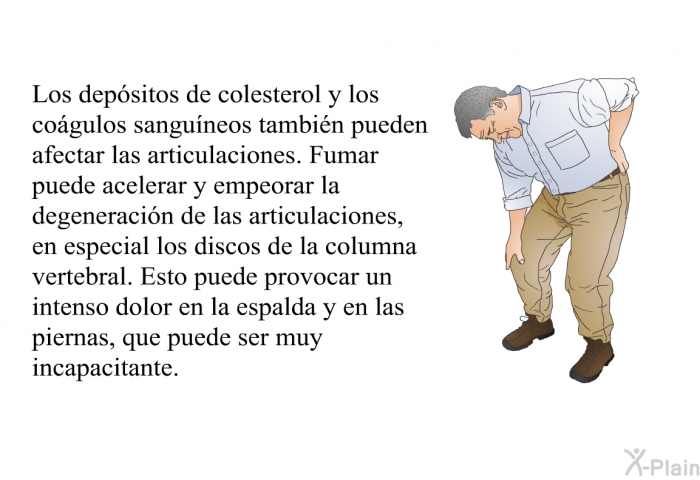 Los depsitos de colesterol y los cogulos sanguneos tambin pueden afectar las articulaciones. Fumar puede acelerar y empeorar la degeneracin de las articulaciones, en especial los discos de la columna vertebral. Esto puede provocar un intenso dolor en la espalda y en las piernas, que puede ser muy incapacitante.