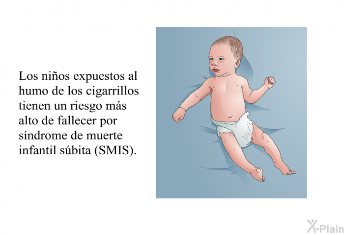 Los nios expuestos al humo de los cigarrillos tienen un riesgo ms alto de fallecer por sndrome de muerte infantil sbita (SMIS).