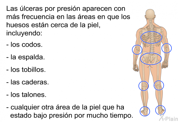 Las �lceras por presi�n aparecen con m�s frecuencia en las �reas en que los huesos est�n cerca de la piel, incluyendo:  los codos. la espalda. los tobillos. las caderas. los talones. cualquier otra �rea de la piel que ha estado bajo presi�n por mucho tiempo.