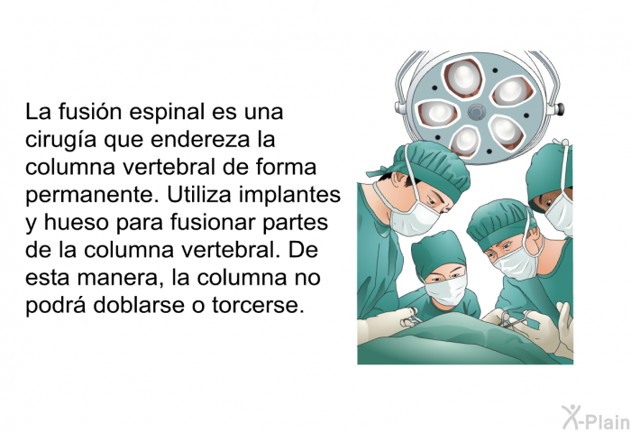 La fusin espinal es una ciruga que endereza la columna vertebral de forma permanente. Utiliza implantes y hueso para fusionar partes de la columna vertebral. De esta manera, la columna no podr doblarse o torcerse.