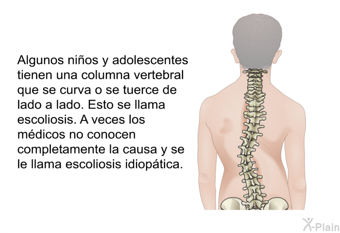 Algunos nios y adolescentes tienen una columna vertebral que se curva o se tuerce de lado a lado. Esto se llama escoliosis. A veces los mdicos no conocen completamente la causa y se le llama escoliosis idioptica.