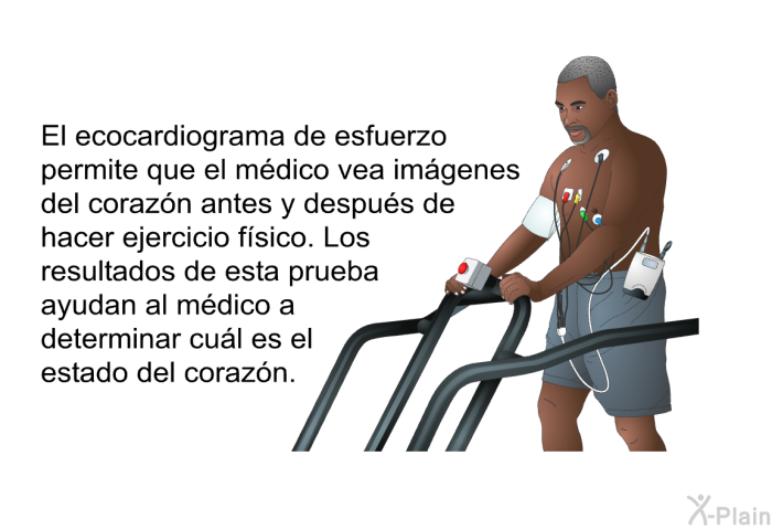 El ecocardiograma de esfuerzo permite que el mdico vea imgenes del corazn antes y despus de hacer ejercicio fsico. Los resultados de esta prueba ayudan al mdico a determinar cul es el estado del corazn.