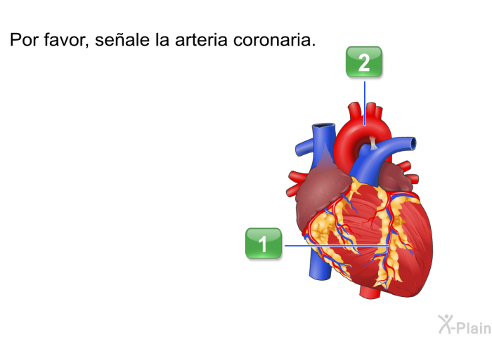 Por favor, seale la arteria coronaria. Presione A o B.