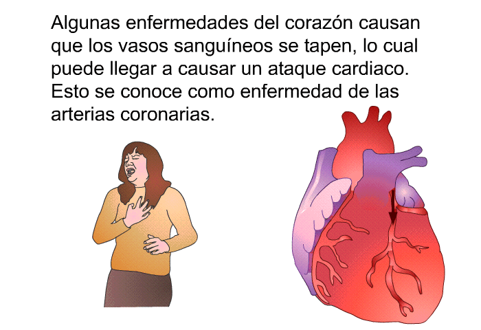 Algunas enfermedades del corazn causan que los vasos sanguneos se tapen, lo cual puede llegar a causar un ataque cardiaco. Esto se conoce como enfermedad de las arterias coronarias.