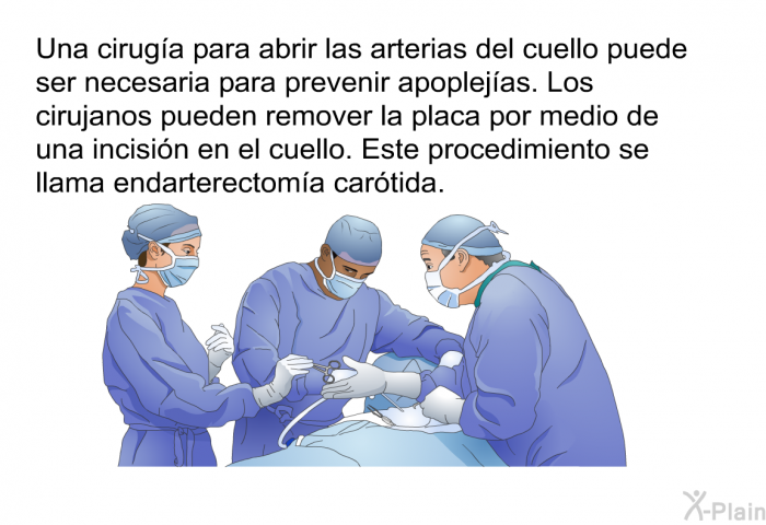 Una ciruga para abrir las arterias del cuello puede ser necesaria para prevenir apoplejas. Los cirujanos pueden remover la placa por medio de una incisin en el cuello. Este procedimiento se llama endarterectoma cartida.