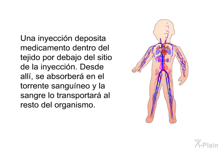 Una inyeccin deposita medicamento dentro del tejido por debajo del sitio de la inyeccin. Desde all, se absorber en el torrente sanguneo y la sangre lo transportar al resto del organismo.