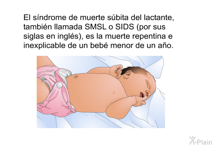 El sndrome de muerte sbita del lactante, tambin llamada SMSL o SIDS (por sus siglas en ingls), es la muerte repentina e inexplicable de un beb menor de un ao.