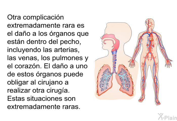 Otra complicacin extremadamente rara es el dao a los rganos que estn dentro del pecho, incluyendo las arterias, las venas, los pulmones y el corazn. El dao a uno de estos rganos puede obligar al cirujano a realizar otra ciruga. Estas situaciones son extremadamente raras.