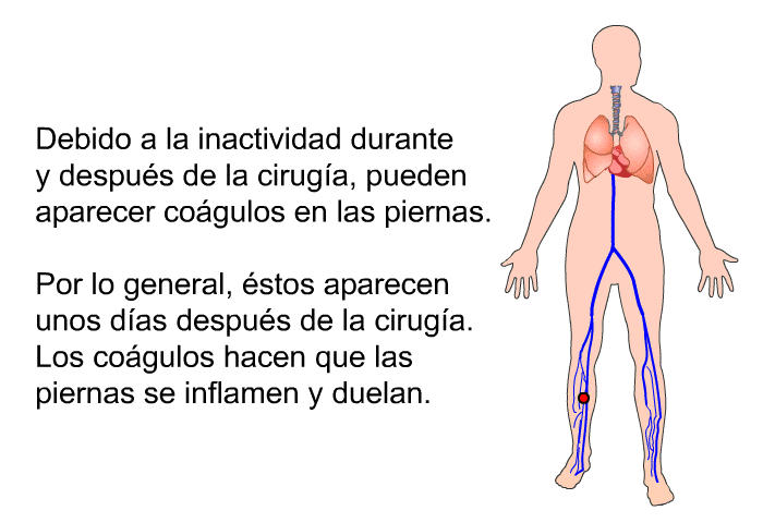 Debido a la inactividad durante y despu�s de la cirug�a, pueden aparecer co�gulos en las piernas. Por lo general, �stos aparecen unos d�as despu�s de la cirug�a. Los co�gulos hacen que las piernas se inflamen y duelan.