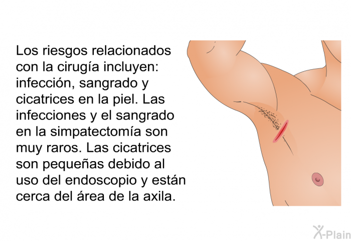 Los riesgos relacionados con la ciruga incluyen: infeccin, sangrado y cicatrices en la piel. Las infecciones y el sangrado en la simpatectoma son muy raros. Las cicatrices son pequeas debido al uso del endoscopio y estn cerca del rea de la axila.