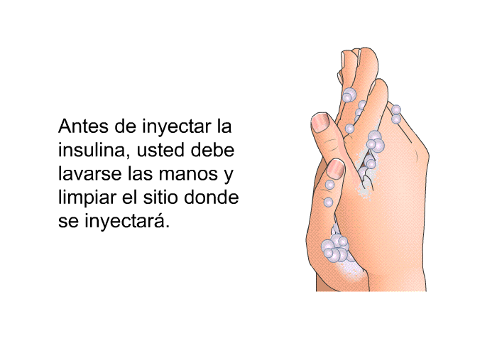 Antes de inyectar la insulina, usted debe lavarse las manos y limpiar el sitio donde se inyectar.