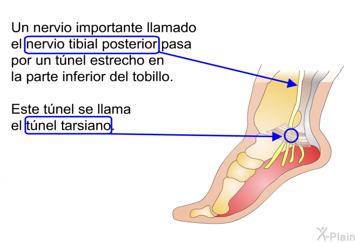 Un nervio importante llamado el nervio tibial posterior pasa por un tnel estrecho en la parte inferior del tobillo. Este tnel se llama el tnel tarsiano.