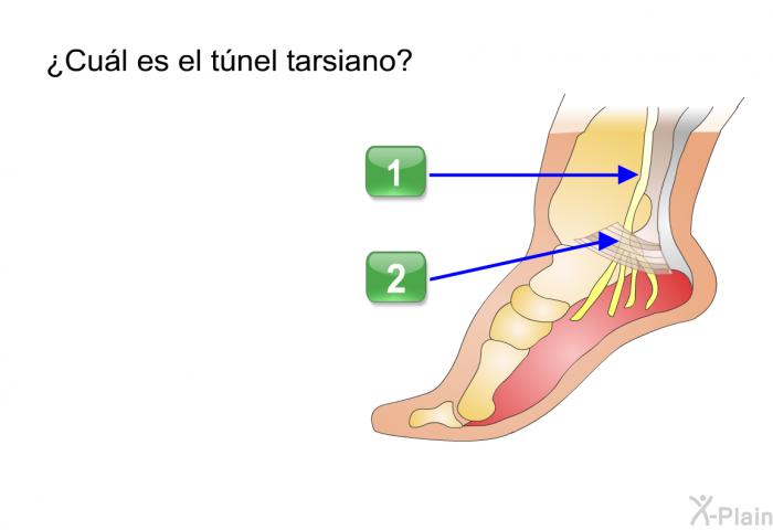 ¿Cul es el tnel tarsiano? Presione A o B.