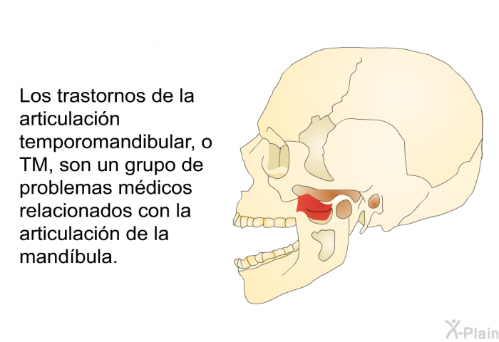Los trastornos de la articulacin temporomandibular, o TM, son un grupo de problemas mdicos relacionados con la articulacin de la mandbula.