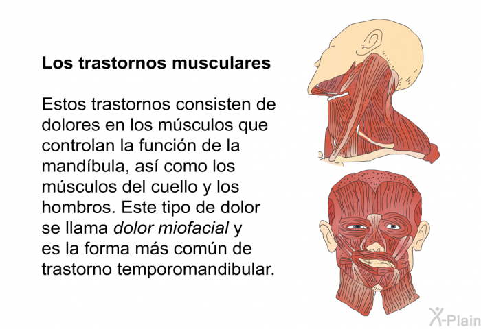 <B>Los trastornos musculares</B>
Estos trastornos consisten de dolores en los msculos que controlan la funcin de la mandbula, as como los msculos del cuello y los hombros. Este tipo de dolor se llama <I>dolor miofacial</I> y es la forma ms comn de trastorno temporomandibular.