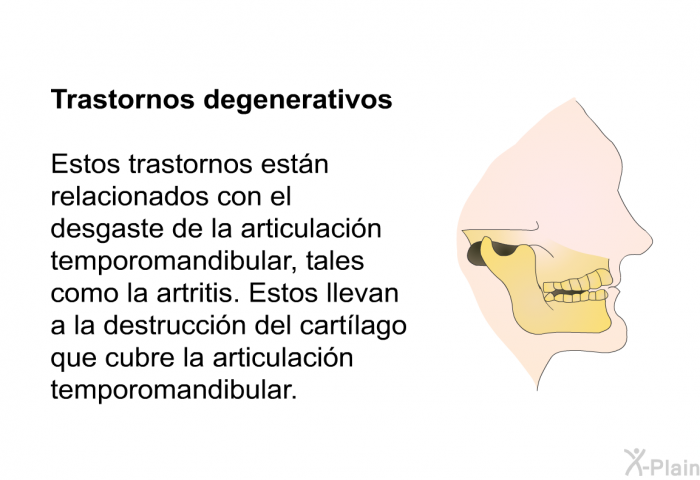 <B>Trastornos degenerativos</B>
Estos trastornos estn relacionados con el desgaste de la articulacin temporomandibular, tales como la artritis. Estos llevan a la destruccin del cartlago que cubre la articulacin temporomandibular.
