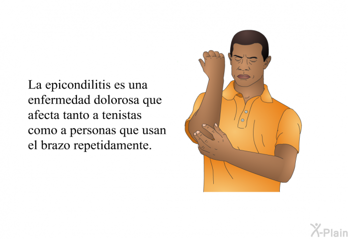 La epicondilitis es una enfermedad dolorosa que afecta tanto a tenistas como a personas que usan el brazo repetidamente.