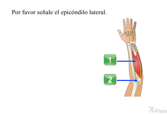 Por favor seale el epicndilo lateral.