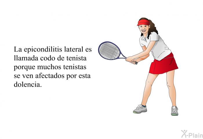 La epicondilitis lateral es llamada codo de tenista porque muchos tenistas se ven afectados por esta dolencia.