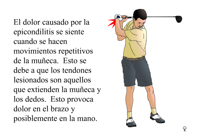 El dolor causado por la epicondilitis se siente cuando se hacen movimientos repetitivos de la mueca. Esto se debe a que los tendones lesionados son aquellos que extienden la mueca y los dedos. Esto provoca dolor en el brazo y posiblemente en la mano.