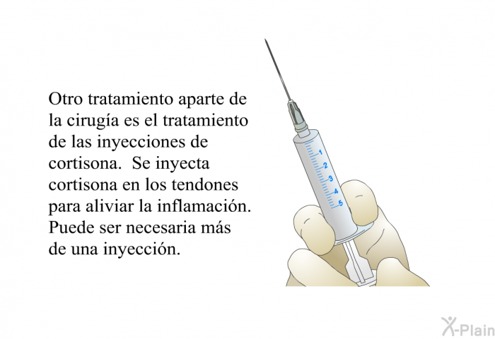 Otro tratamiento aparte de la ciruga es el tratamiento de las <I>inyecciones de cortisona</I>. Se inyecta cortisona en los tendones para aliviar la inflamacin. Puede ser necesaria ms de una inyeccin.