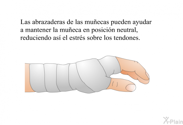 Las abrazaderas de las mu�ecas pueden ayudar a mantener la mu�eca en posici�n neutral, reduciendo as� el estr�s sobre los tendones.