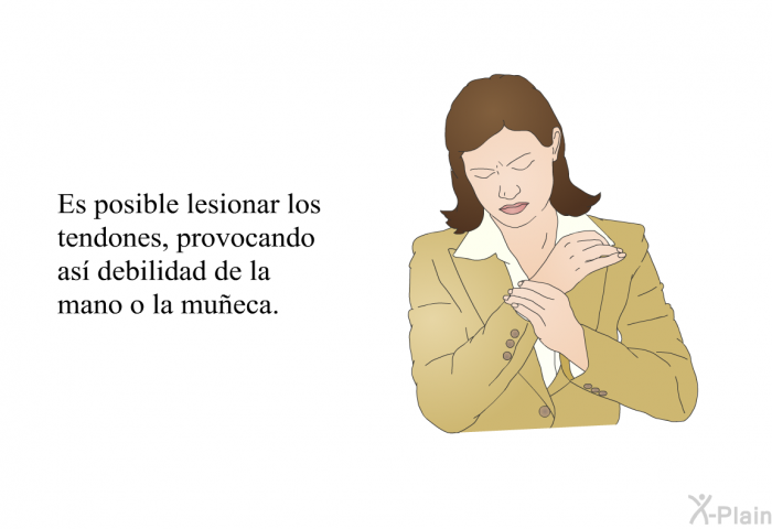 Es posible lesionar los tendones, provocando as debilidad de la mano o la mueca.