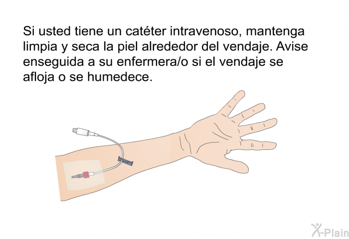 Si usted tiene un catter intravenoso, mantenga limpia y seca la piel alrededor del vendaje. Avise enseguida a su enfermera/o si el vendaje se afloja o se humedece.