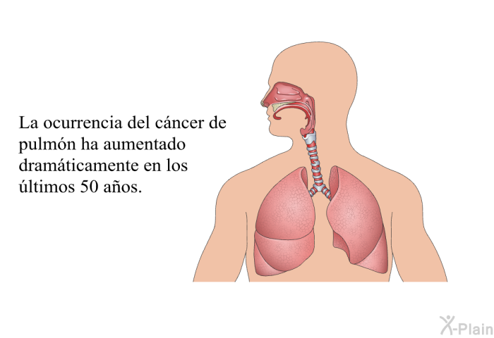 La ocurrencia del cncer de pulmn ha aumentado dramticamente en los ltimos 50 aos.