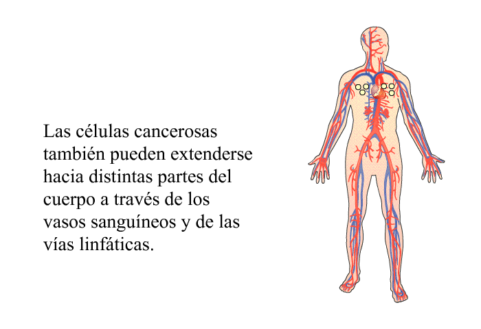 Las clulas cancerosas tambin pueden extenderse hacia distintas partes del cuerpo a travs de los vasos sanguneos y de las vas linfticas.