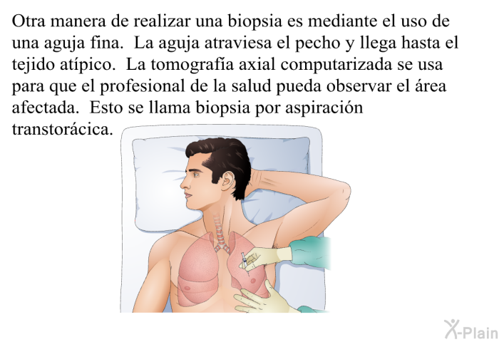 Otra manera de realizar una biopsia es mediante el uso de una aguja fina. La aguja atraviesa el pecho y llega hasta el tejido at�pico. La tomograf�a axial computarizada se usa para que el profesional de la salud pueda observar el �rea afectada. Esto se llama <I>biopsia por aspiraci�n transtor�cica.</I>