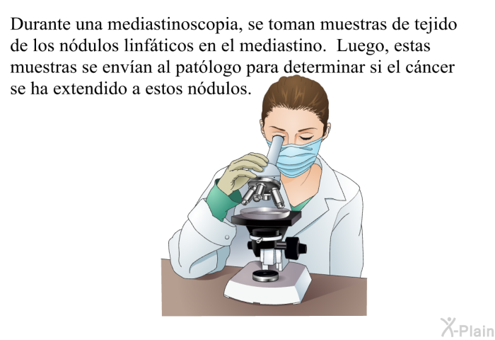 Durante una mediastinoscopia, se toman muestras de tejido de los ndulos linfticos en el mediastino. Luego, estas muestras se envan al patlogo para determinar si el cncer se ha extendido a estos ndulos.