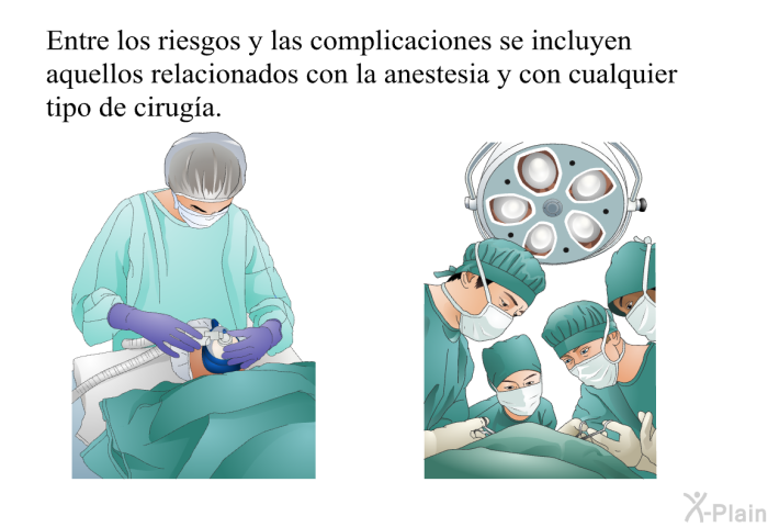 Entre los riesgos y las complicaciones se incluyen aquellos relacionados con la anestesia y con cualquier tipo de ciruga.