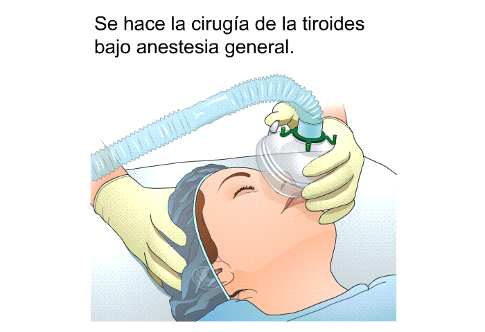 Se hace la ciruga de la tiroides bajo anestesia general.