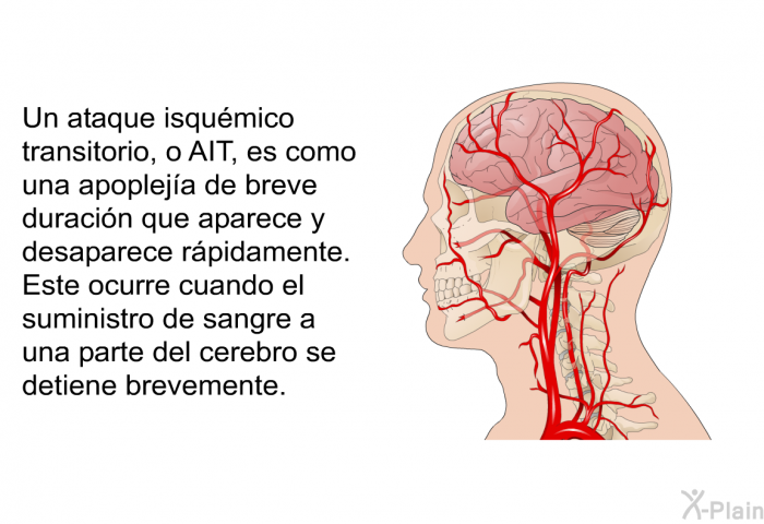 Un ataque isqumico transitorio, o AIT, es como una apopleja de breve duracin que aparece y desaparece rpidamente. Este ocurre cuando el suministro de sangre a una parte del cerebro se detiene brevemente.