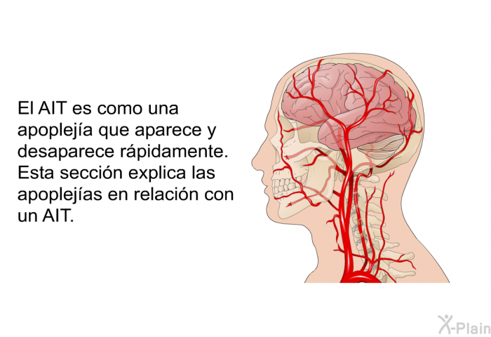 El AIT es como una apopleja que aparece y desaparece rpidamente. Esta seccin explica las apoplejas en relacin con un AIT.