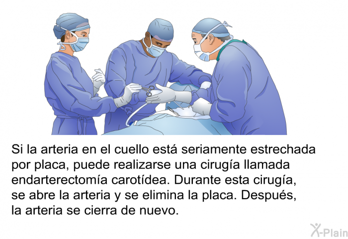 Si la arteria en el cuello est seriamente estrechada por placa, puede realizarse una ciruga llamada endarterectoma carotdea. Durante esta ciruga, se abre la arteria y se elimina la placa. Despus, la arteria se cierra de nuevo.