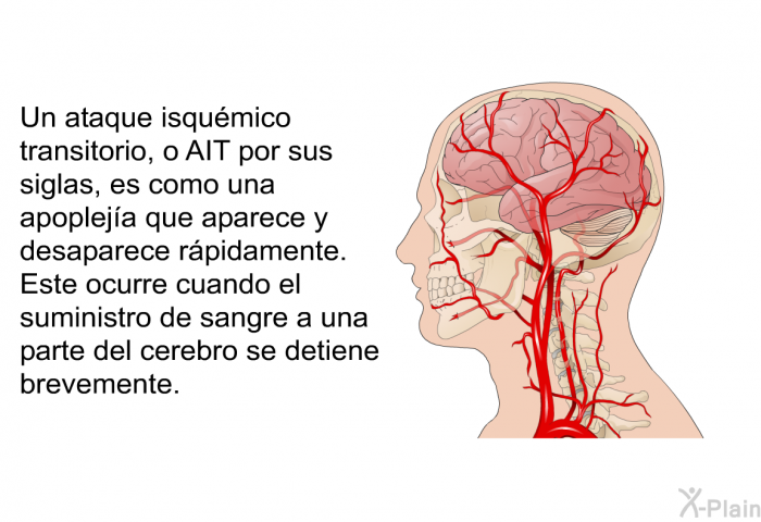 Un ataque isqumico transitorio, o AIT por sus siglas, es como una apopleja que aparece y desaparece rpidamente. Este ocurre cuando el suministro de sangre a una parte del cerebro se detiene brevemente.