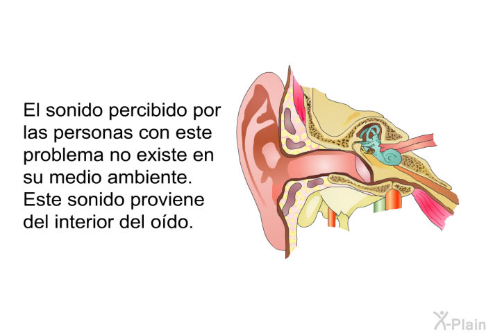 El sonido percibido por las personas con este problema no existe en su medio ambiente. Este sonido proviene del interior del odo.