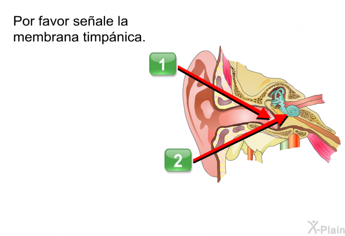 Por favor seale la membrana timpnica.