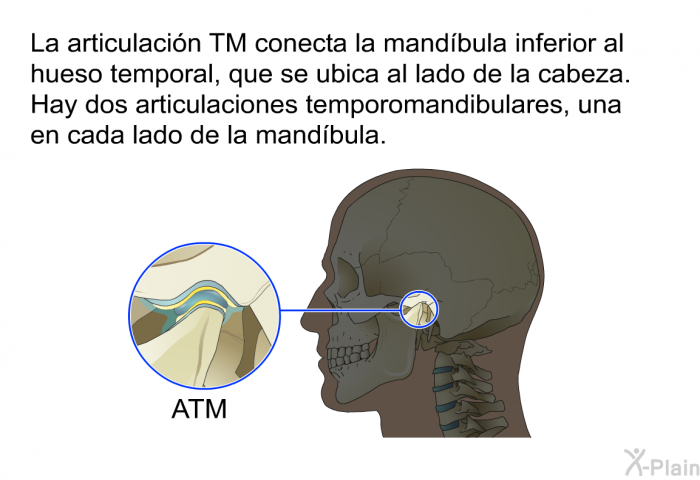 La articulacin TM conecta la mandbula inferior al hueso temporal, que se ubica al lado de la cabeza. Hay dos articulaciones temporomandibulares, una en cada lado de la mandbula.