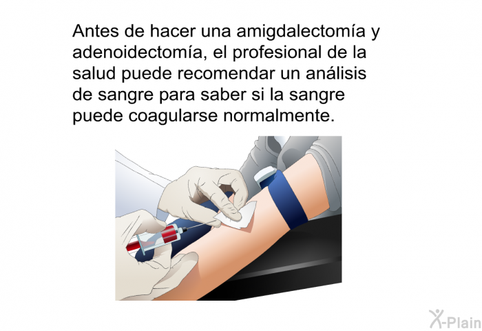 Antes de hacer una amigdalectoma y adenoidectoma, el profesional de la salud puede recomendar un anlisis de sangre para saber si la sangre puede coagularse normalmente.